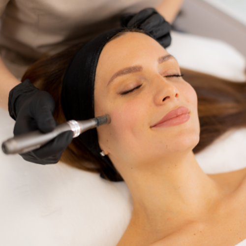 Microneedling Microdermabrasion Facial